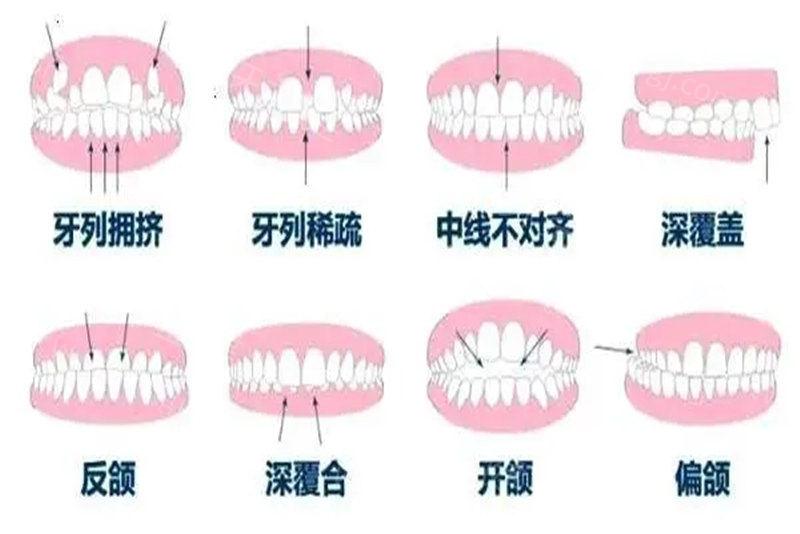 牙齿健康情况