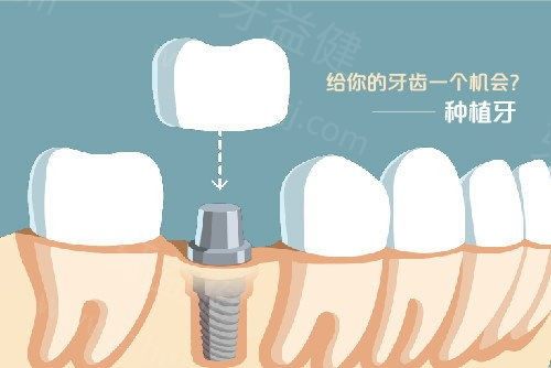 广州牙科医院排名前十名单已更新：正畸种植牙实力牙科推荐