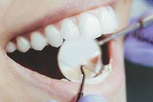 治疗门牙大的三种理想方法