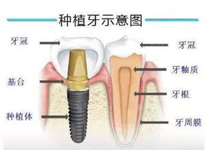 徐州美奥口腔医院收费标准
