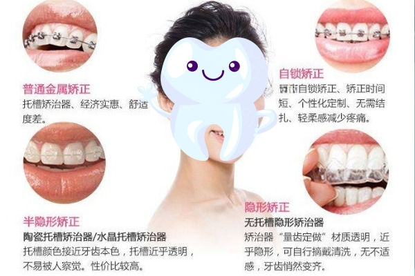 常见牙齿矫正方式