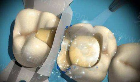 上海雅悦口腔价格收费表更新