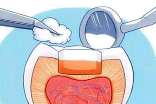 重庆牙科医院哪家补牙好？本地牙友都推荐的高性价比牙科名单