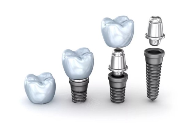 太原种植牙哪个医院种得好