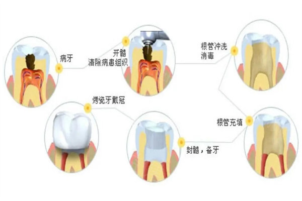 武汉牙达人口腔收费标准:假牙800+金属矫正5000+很实惠