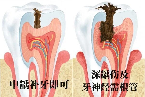 赤峰陈氏口腔收费