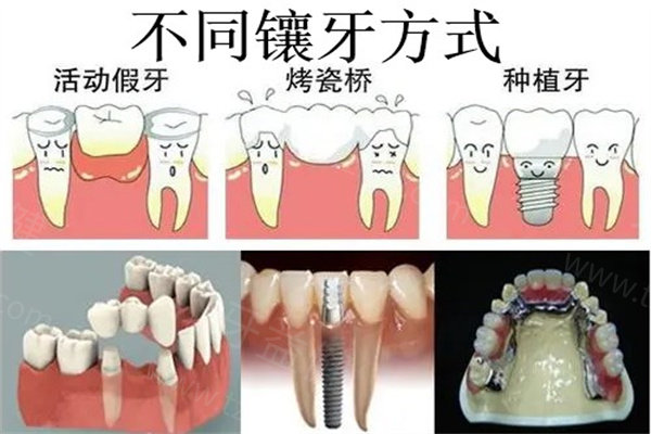 天津镶牙口碑好的医院排名前十名：小编根据近期的医院信息给大家分享以下这些天津镶牙技术正规且口碑好的牙科实力吧！