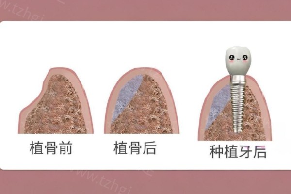 长沙韩国种植牙有名的口腔医院排名