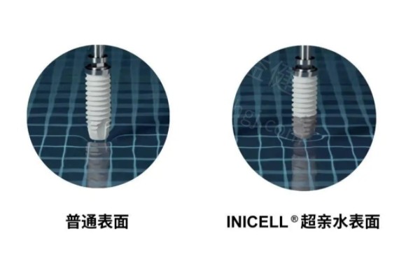 长沙韩国种植牙有名的口腔医院排名