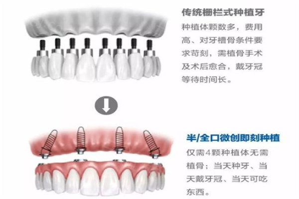 北<span style=