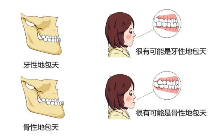 北京正颌手术哪家技术好?分享技术可靠排名前3医院及2024正颌手术价格表