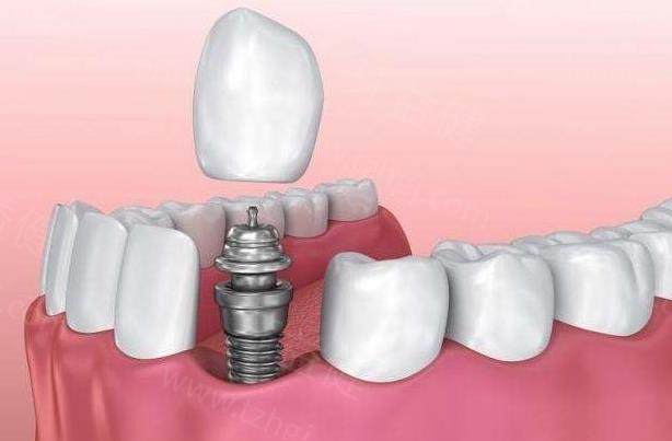 1722941632746709.jpg 微信截图_20230703140615.jpg