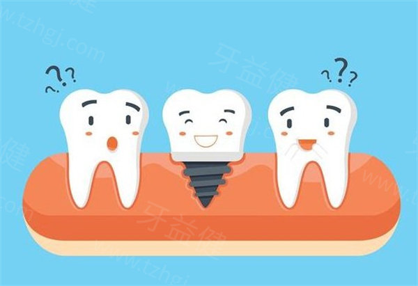 全新太原种植牙价格表:种植牙3580+半口种植牙30000+全口种植牙50000+