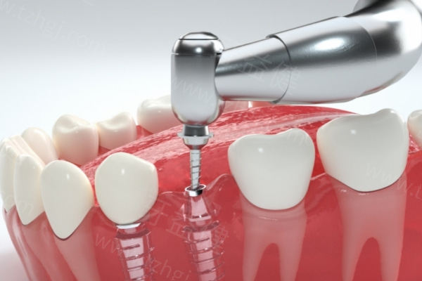 医院牙科收费价目表2025版发布 翻新种牙/箍牙/拔牙/牙齿美白价格表超全 医院牙科收费价目表2025版发布 翻新种牙/箍牙/拔牙/牙齿美白价格表超全