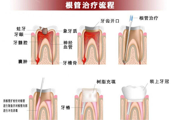 广州正规牙科医院收费标准