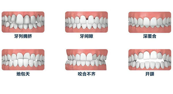 牙齿矫正18.jpg