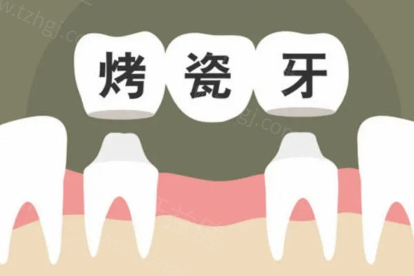 2024-2025年张家口牙科收费价格表 补牙/镶牙/拔牙/矫正/种牙价格大全附医院