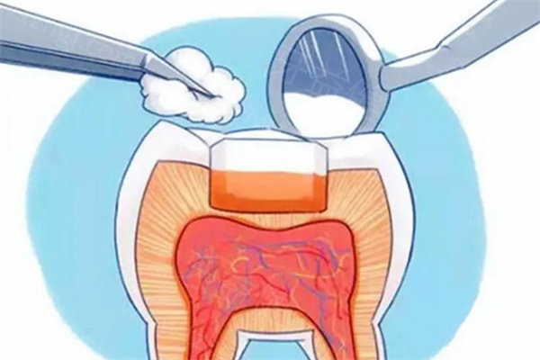 温州口腔医院补牙价格