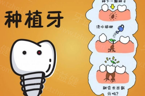 安徽芜湖牙齿种植多少钱 种植牙5000+矫正8000+洗牙79+补牙99+拔牙300+