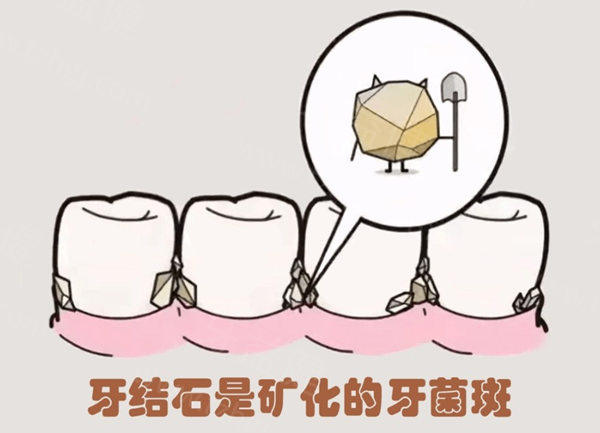 牙齿修复收费价目表 牙齿修复收费价目表