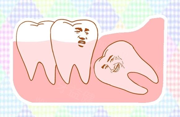 天津牙科医院看牙贵吗