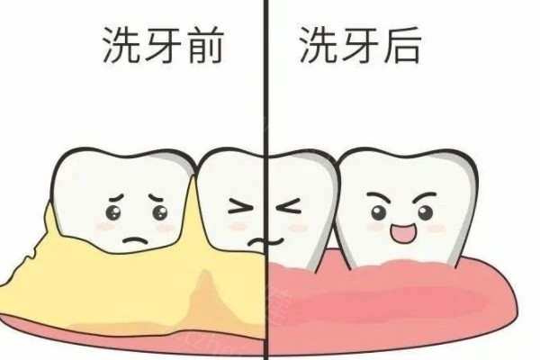 西安正规便宜洗牙医院排行榜推荐