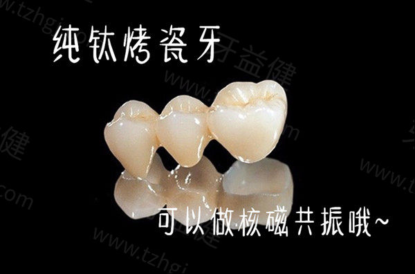 纯钛烤瓷牙