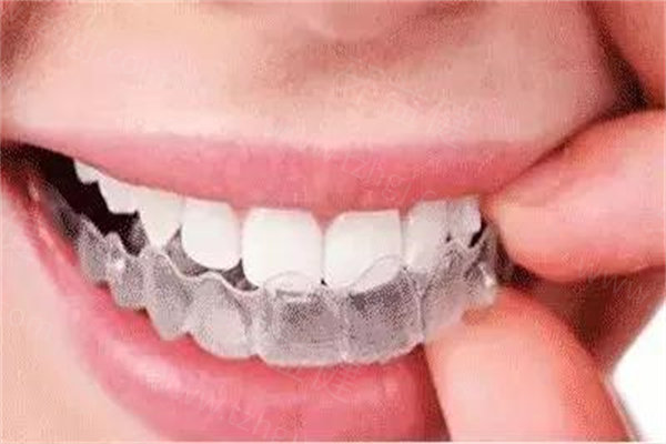 绵阳牙齿矫正多少钱? 绵阳牙齿矫正多少钱?