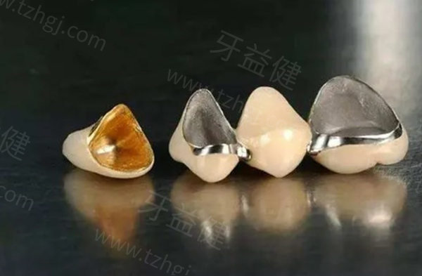 兰州牙冠修复需多少钱一颗