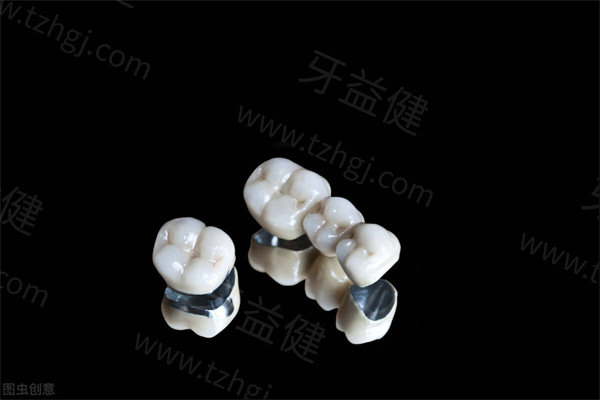 包头烤瓷牙、全瓷牙、活动假牙多少钱一颗？