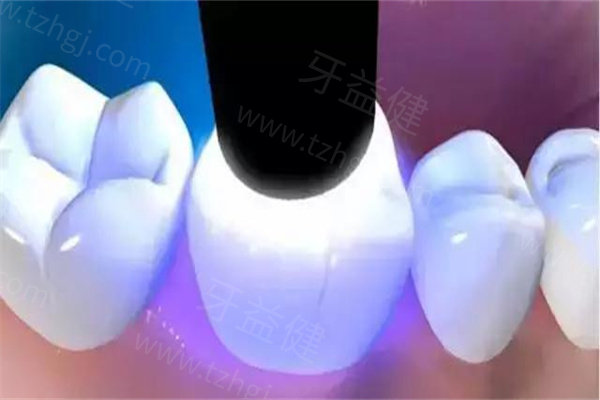 包头补牙、拔智齿、根管治疗多少钱一颗？