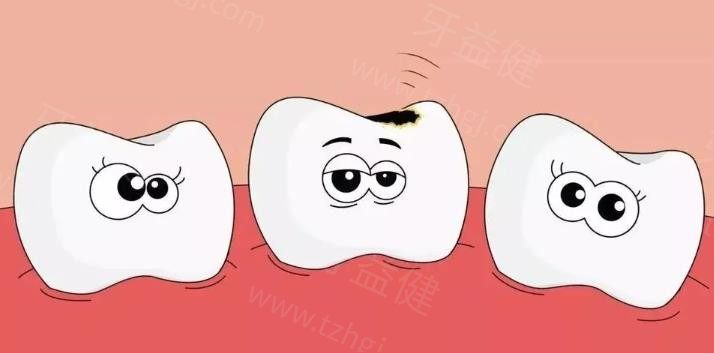 厦门拔智齿哪家医院好价格便宜? 思明美洁、登特、连芳口腔拔牙好都在榜