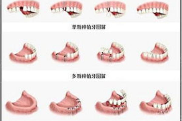 广州荔湾口腔医院十大排行 都说这几家看牙实惠