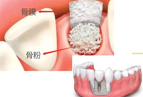 松江看牙齿比较好又便宜的医院