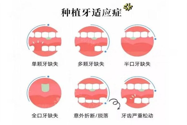沈阳种植牙十大口腔医院排名 沈阳种植牙十大口腔医院排名