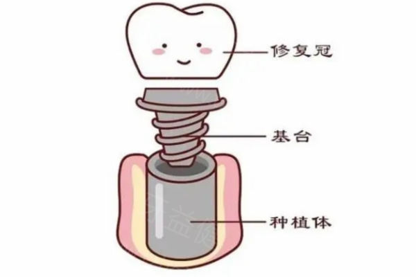 25版银川口腔医院收费价格表 种牙/补牙/洗牙/美白/整牙价格合理