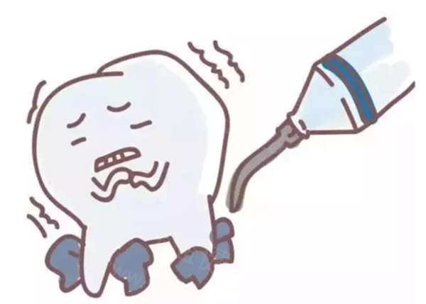 影响洗牙价格的关键因素