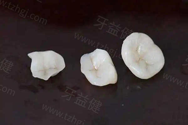 2025广州补牙多少钱一颗牙