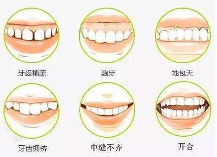 重庆种博士口腔医院地址在江北区华新街,种植牙3980+正畸6000+烤瓷牙600+口碑好又便宜