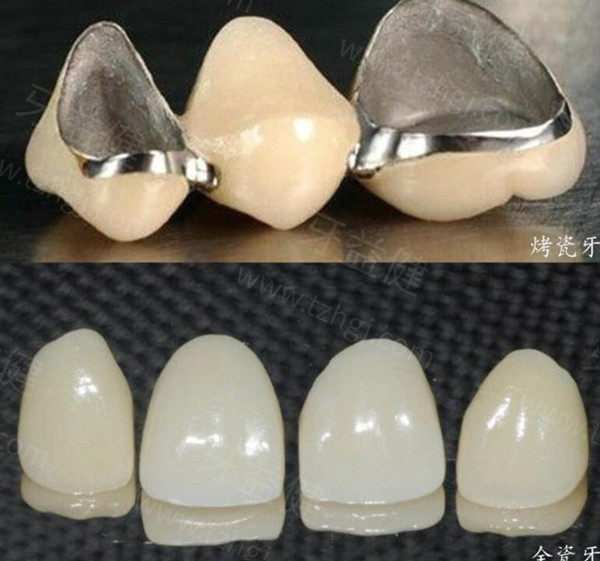 重庆种博士口腔医院地址在江北区华新街,种植牙3980+正畸6000+烤瓷牙600+口碑好又便宜
