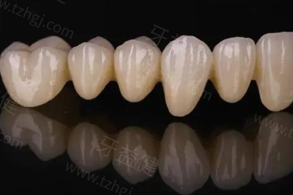 北京全瓷牙哪家牙科医院好?这5家全瓷牙/烤瓷牙都做得好 北京全瓷牙哪家牙科医院好?这5家全瓷牙/烤瓷牙都做得好