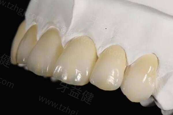 北京全瓷牙哪家牙科医院好?这5家全瓷牙/烤瓷牙都做得好 北京全瓷牙哪家牙科医院好?这5家全瓷牙/烤瓷牙都做得好