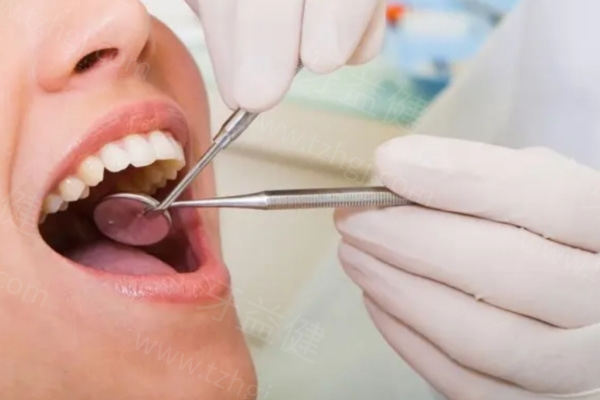 速来看!25版正规医院补一颗牙要多少钱可以报销吗?补牙材料不同价格不同