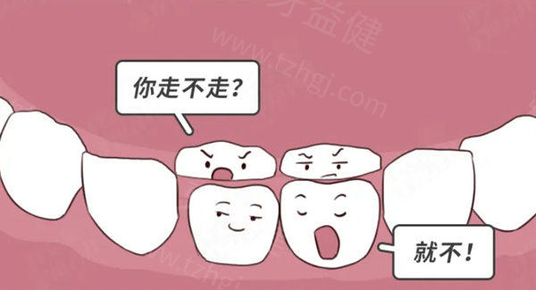杭州补牙多少钱一颗?查看杭州补牙/拔牙/正畸/种植牙收费价格真不贵
