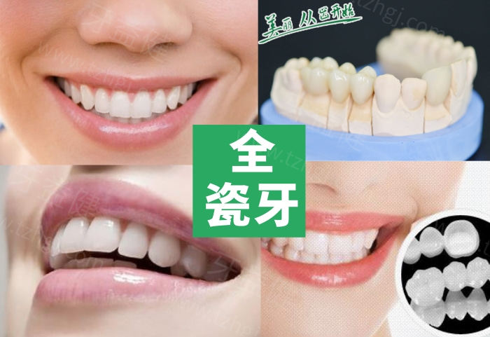 全瓷牙冠确定.jpg