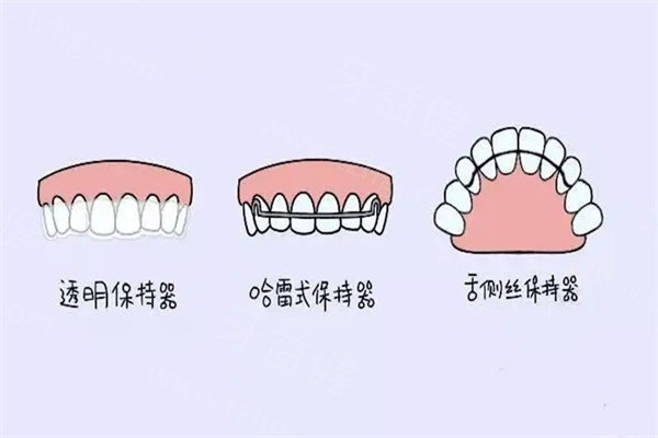 牙齿矫正保持器