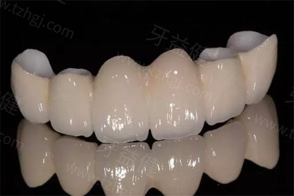 微笑口腔医院烤瓷牙、全瓷牙多少钱一颗？