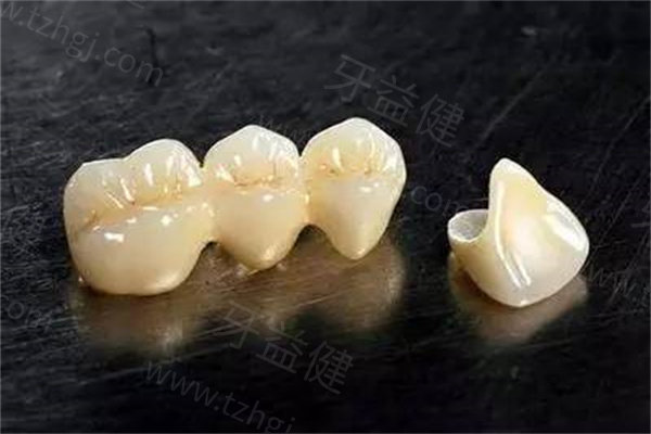 成都牙冠多少钱一颗