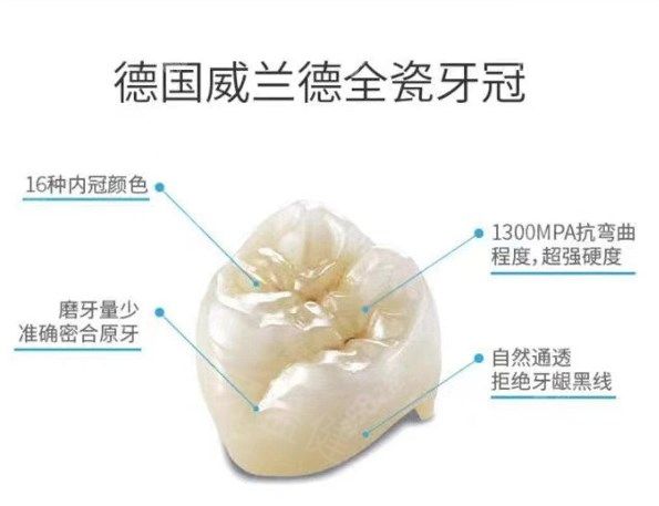 国内常用牙冠品牌排行榜前十名公布:附2025年牙冠价格表