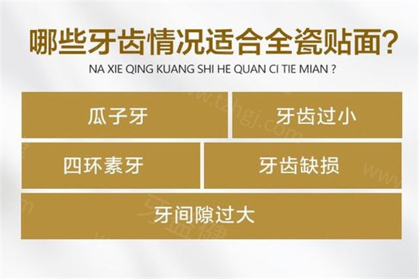 全口牙齿贴片要多少钱？分享牙医常用牙贴面材料种类及价格表